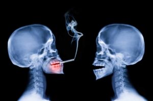 Image of two skeletons in X-ray, one is smoking.